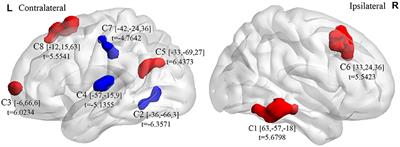 Altered Spontaneous Brain Activity and Network Property in Patients With Congenital Monocular Blindness